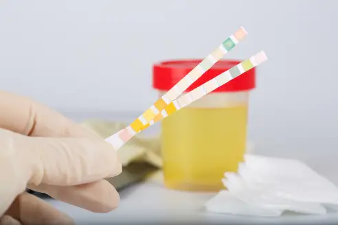 Urine Drug Tests